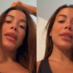 O que é infecção bacteriana severa? Entenda o problema que atingiu a cantora Anitta