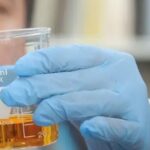 Brasil tem 58 casos de intoxicação por metanol; mortes chegam a 15 Brasil tem 58 casos de intoxicação por metanol; mortes chegam a 15