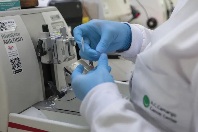 Cura do Câncer de Próstata: Chance de Até 98%? Entenda os Detalhes!