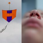 Menina de 7 anos é ferida por linha com cerol no bairro Rio Branco