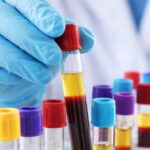 Brusque inicia mutirão para agilizar exames laboratoriais no sábado (18/4)