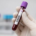 Homem é condenado a indenizar ex-companheira após transmissão do vírus HIV