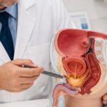 Câncer de bexiga deve afetar mais de 13 mil brasileiros por ano, prevê o INCA
