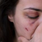Mulher é espancada, esganada e ameaçada com enxada pelo companheiro em SC