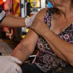 Mulher de 66 anos fica ferida após ser agredida em Brusque