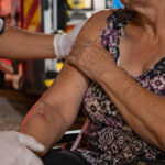 Mulher de 66 anos fica ferida após ser agredida em Brusque