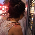 Mulher é atacada a facadas enquanto dormia e foge com faca cravada no ombro em SC